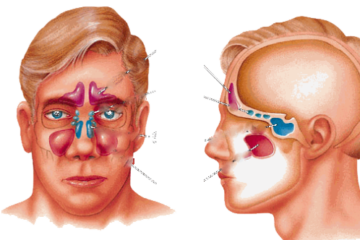 Sinüzit ve Burun