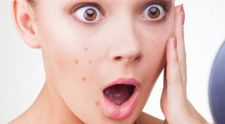 Kanda bulunan rejenerasyon hızlandırıcı PRP ayrılıp gerekli noktalara enjeksiyon yoluyla uygulanır. Gerekli görülürse XFC,Cellucare veya Stretchcare eklenirse ürün başına fiyata 500 TL eklenecektir